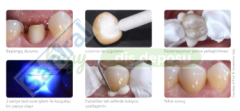 GC  FujiCEM Evolve Automix 3'lü